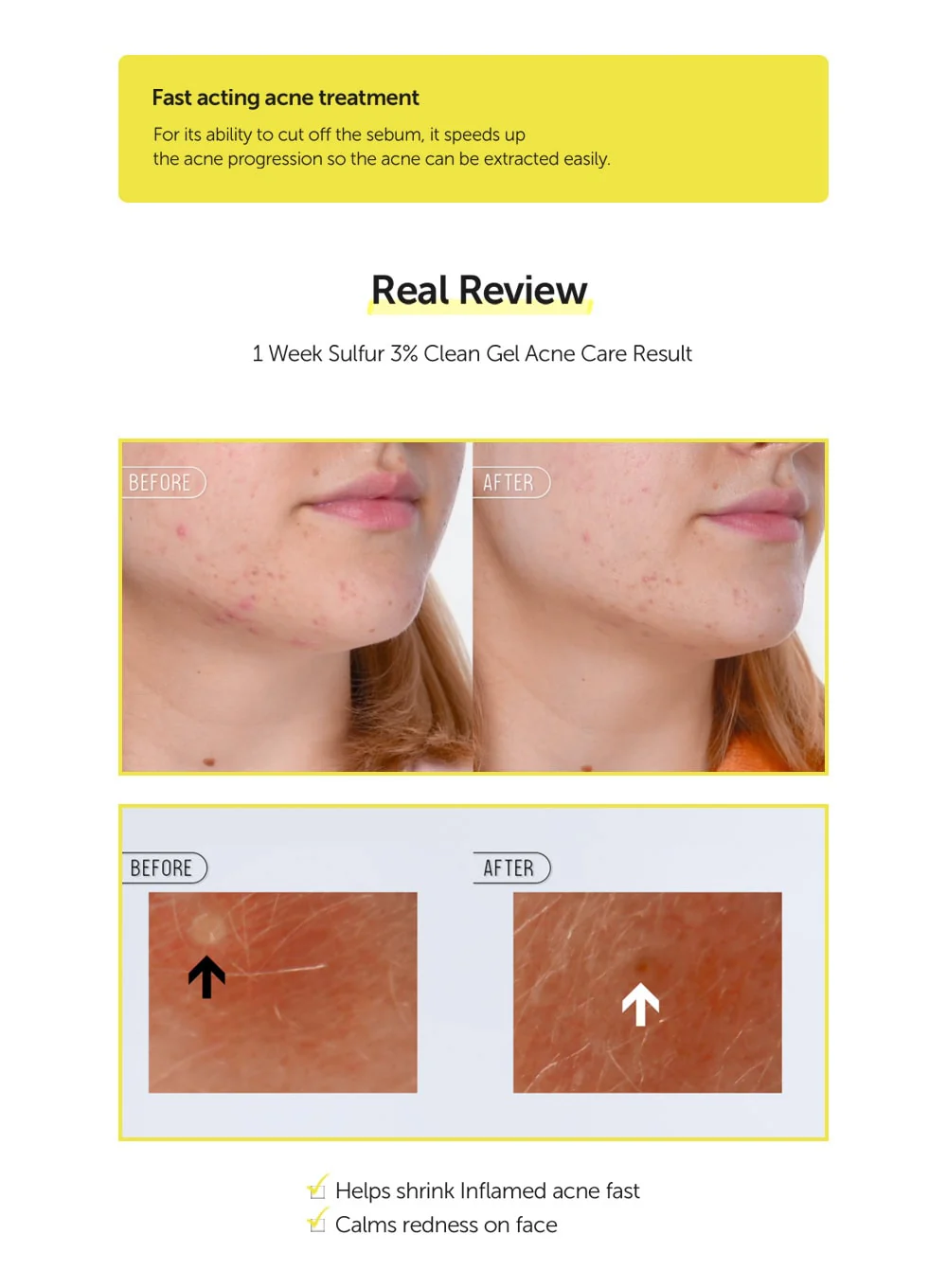 Sulfur 3% Clean Gel (30g) - Image 8